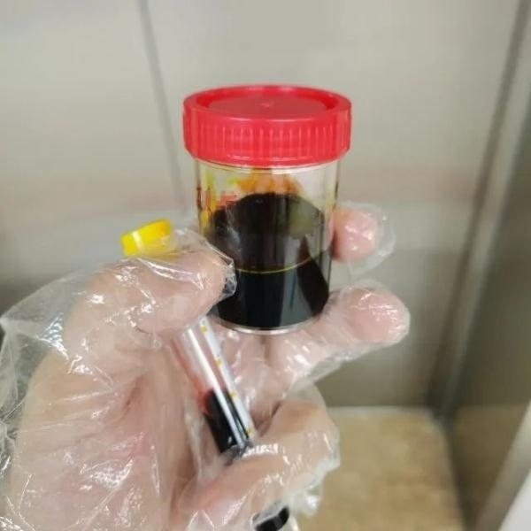 急性肝衰竭！兩兄弟誤吃這種菌 專家提醒